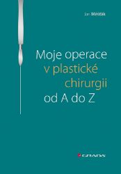 Moje operace v plastické chirurgii od A do Z Moje operace v plastické chirurgii od A do Z