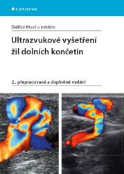 Ultrazvukové vyšetření žil dolních končetin Ultrazvukové vyšetření žil dolních končetin