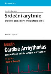 Srdeční arytmie praktické poznámky k interpretaci a léčbě Srdeční arytmie praktické poznámky k interpretaci a léčbě