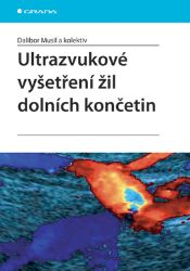 Ultrazvukové vyšetření žil dolních končetin Ultrazvukové vyšetření žil dolních končetin