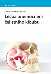 Léčba onemocnění čelistního kloubu