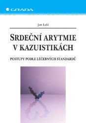 Srdeční arytmie v kazuistikách - Lékařská literatura e-knihy Srdeční arytmie v kazuistikách