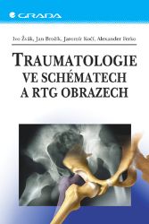 Traumatologie ve schématech a RTG obrazech - Lékařská literatura e-knihy Traumatologie ve schématech a RTG obrazech