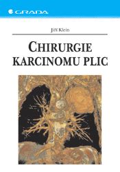 Chirurgie karcinomu plic Chirurgie karcinomu plic