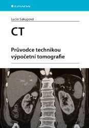 CT - Průvodce technikou výpočetní tomografie