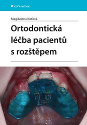 Ortodontická léčba pacientů s rozštěpem Ortodontická léčba pacientů s rozštěpem