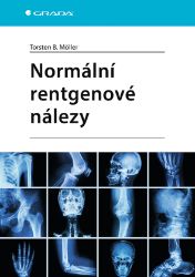 Normální rentgenové nálezy - Lékařská literatura e-knihy Normální rentgenové nálezy