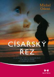 Císařský řez Císařský řez