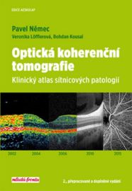Optická kohereční tomografie