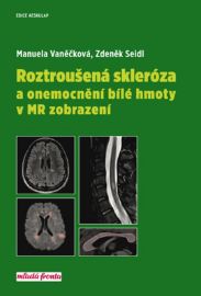 Roztroušená skleróza a onemocnění bílé hmoty v MR zobrazení