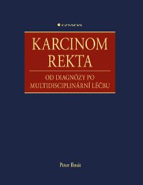 Karcinom rekta