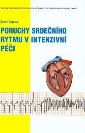 Poruchy srdečního rytmu v intenzivní péči