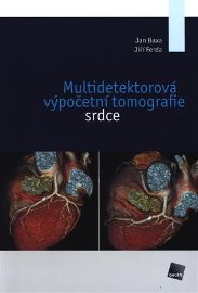 Multidetektorová výpočetní tomografie srdce