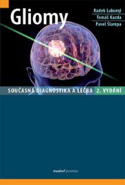 Gliomy - Současná diagnostika a léčba