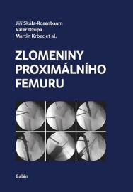Zlomeniny proximálního femuru