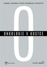 Onkologie v kostce