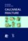 Calcaneal Fracture Calcaneal Fracture