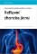 Refluxní choroba jícnu Refluxní choroba jícnu