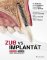 Zub vs. implantát Zub vs. implantát