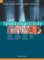 Spondyloartritidy Spondyloartritidy