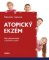 Atopický ekzém Atopický ekzém