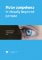 Motor competence in visually impaired persons Motor competence in visually impaired persons