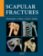 Scapular fractures