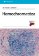 Hemochromatóza