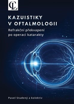 Kazuistiky v oftalmologii