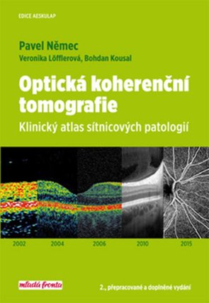 Optická kohereční tomografie