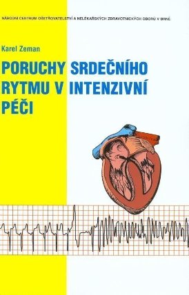 Poruchy srdečního rytmu v intenzivní péči
