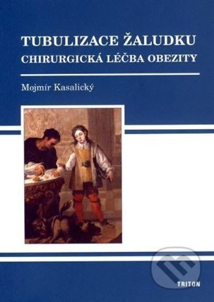 Tubulizace žaludku