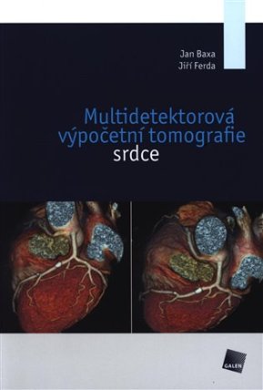 Multidetektorová výpočetní tomografie srdce