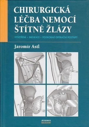 Chirurgická léčba nemocí štítné žlázy