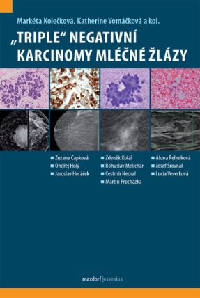 „Triple“ negativní karcinomy mléčné žlázy
