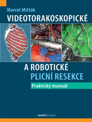 Videotorakoskopické a robotické plicní resekce