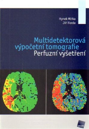 Multidetektorová výpočetní tomografie
