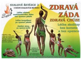 Zdravá záda / Zdravá chůze - Léčba skoliózy bez korzetu a bez operace