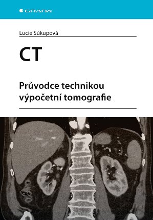 CT - Průvodce technikou výpočetní tomografie