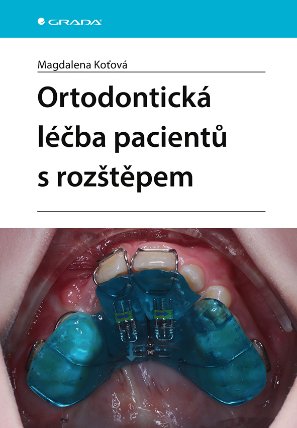 Ortodontická léčba pacientů s rozštěpem